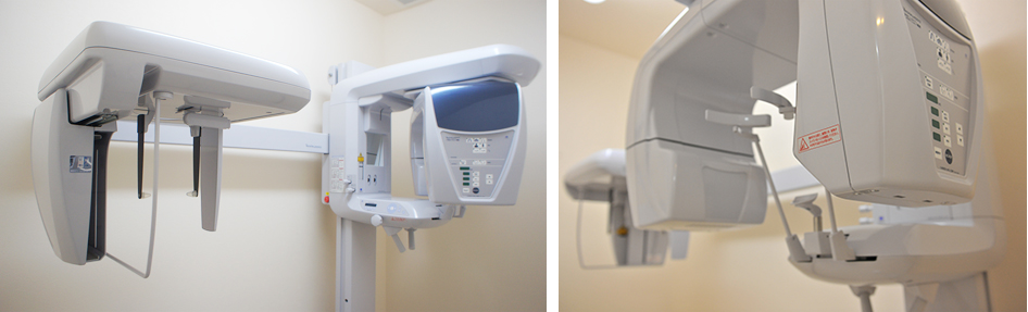 デジタルレントゲン